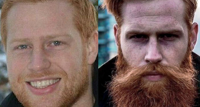 Як сором'язливий британець відростив бороду, яка повністю змінила все його життя