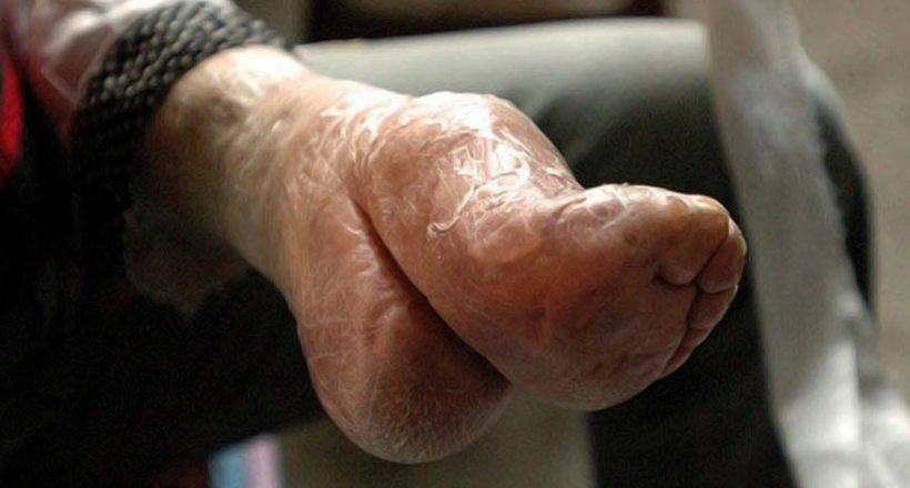 «Золоті лотоси» — жорстока традиція бинтування жіночих ніг у Китаї