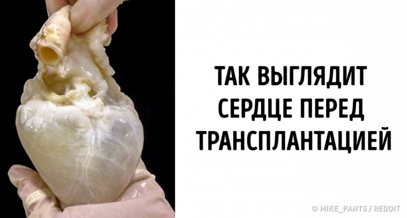 19 дивовижних фото, після яких можна сказати, що тепер ви бачили все