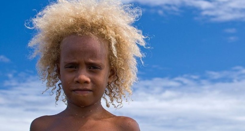 Чому темношкірі меланезійці народжуються блондинами