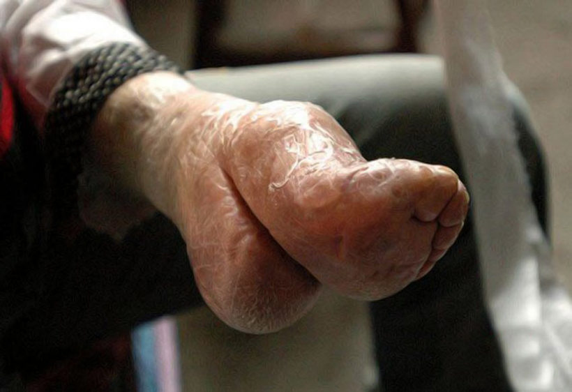 31 немислима фотографія «лотосових ніжок» китайських жінок